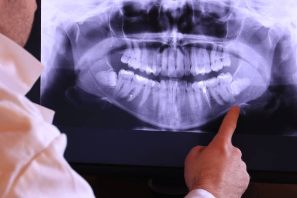 Best Emergency Tooth Extraction in Hamlin, WV